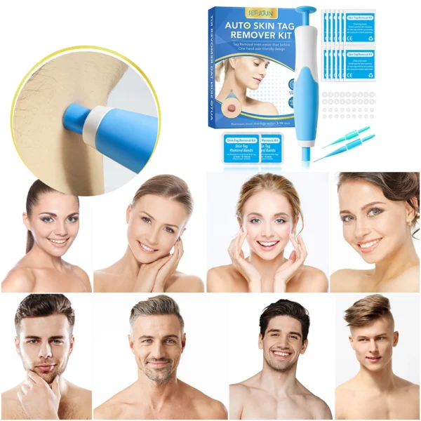 2 IN 1 Auto Micro Skin Tag Remover Device Standard And Micro Skin Tag Removal Kit Adult Mole Wart Remover Face Care Beauty Tools - Image 4