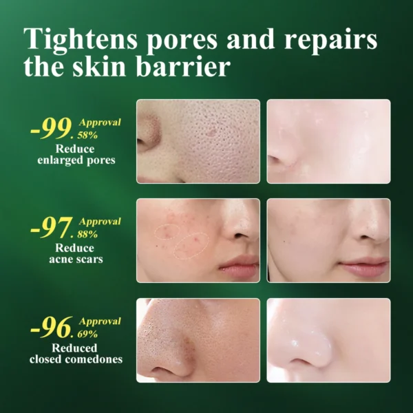 MABREM Pore Shrinking Serum Essence Pores Treatment Moisturizing Relieve Dryness Oil-Control Firming Repairing Smooth Skin Care - Image 2