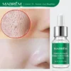 MABREM Pore Shrinking Serum Essence Pores Treatment Moisturizing Relieve Dryness Oil-Control Firming Repairing Smooth Skin Care